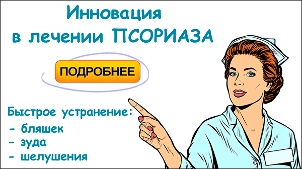 Инновация